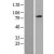 Western Blot: ABCD1 Lysate [NBL1-07179] - Western Blot experiments.  Left-Control; Right -Over-expression Lysate for ABCD1.